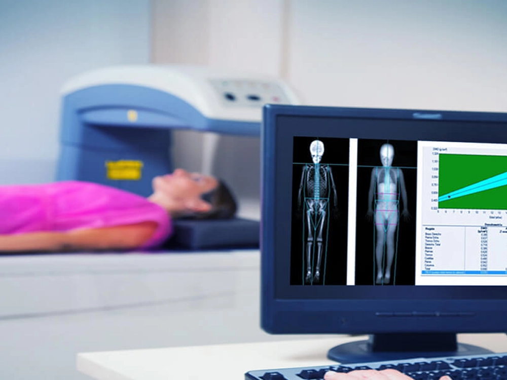 Equipamento de densitometria óssea